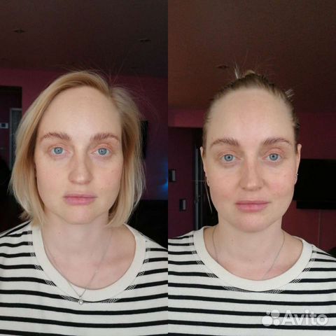 Массаж лица